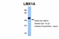 LMX1A Rabbit anti-Human, Polyclonal, Novus Biologicals 0.1ml; Unconjugated:Antibodies,